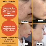 Big 2.11oz. Organic Vitamin C Serum for Face. Anti-Dark Spots, Wrinkles Skin Repair Serum with Hyaluronic Acid, Vitamin C & Niacinamide. All-in-One Brightening, Anti Aging Facial & Eye Area Skincare