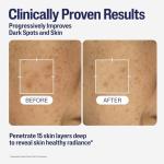 Cetaphil Healthy Radiance Brightening Serum with Niacinamide for Skin Pigmentation, 30ml