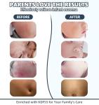 Bath Water Filter for Tub Faucet - 2,500 Gallons