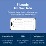 KardiaMobile 6L EKG Monitor with KardiaCare Subscription