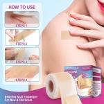 Scar Removal Silicone Tape for Hypertrophic Scars & Keloids, 1.6'' x 60''-150"