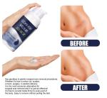 Advanced Silicone Scar Gel Cream, for Surgical Scars, Stretch Marks, Acne