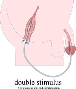 Urethral Dillator with Smooth Double Head Stainless Steel Plug Adult Toys - Cath