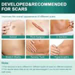 2pack Overnight Silicone Wrinkle Patches Face Anti Wrinkle Tape Forehead Neck