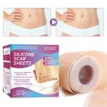 Scar Removal Silicone Tape for Hypertrophic Scars & Keloids, 1.6'' x 60''-150"