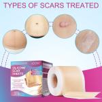 Scar Removal Silicone Tape for Hypertrophic Scars & Keloids, 1.6'' x 60''-150"