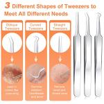 Blackhead Remover Tool Kit, IUMAKEVP 15 PCS Professional Stainless Steel Pimple Popper Comedone Extractor Tools for Removing Pimple, Blackheads, Zit on Face - Acne Removal Kit with Metal Case(Silvery)