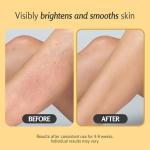 Turmeric Exfoliator and Moisturizer for Sensitive Skin