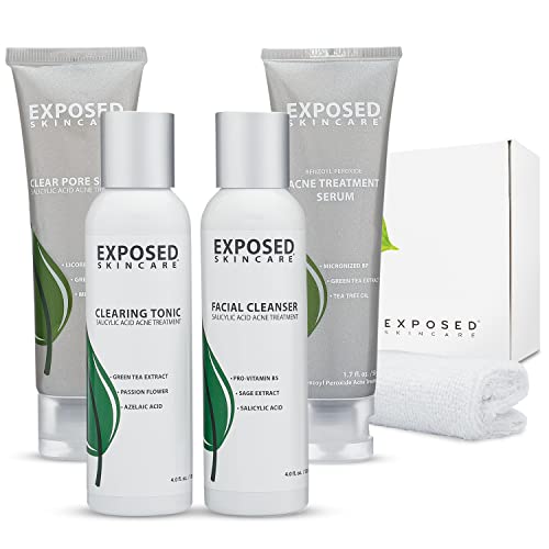 Exposed Skin Care Acne Treatment System (60 Day) 5 Piece Basic Kit Heals and Prevents Teen/Adult Breakouts with Benzoyl Peroxide 3.5%, Salicylic Acid and Healthy Natural Extracts
