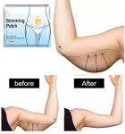 KONGDY 50 Strong Slimming Patches for Fast Weight Loss