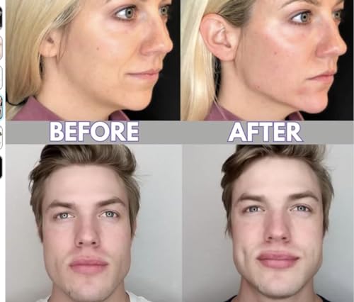 APE Training Jaw Exerciser - 3 Pack, 3 Levels