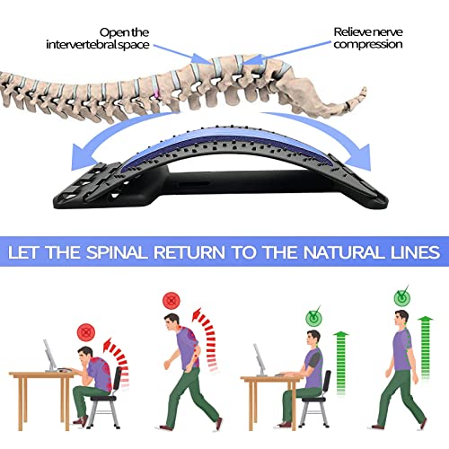 UUCOLOR Back Stretcher: Adjustable Spine Posture Massager (Blue)