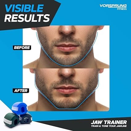VORSPRUNG® Jaw Exerciser - Achieve Enhanced Facial Definition!