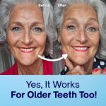 MySweetSmile Whitening Powder - Dentist Recommended Mint Flavor