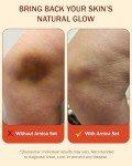 Arnica Cream & Roll-On Set for Bruises Relief