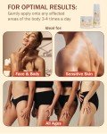 Arnica Cream & Roll-On Set for Bruises Relief