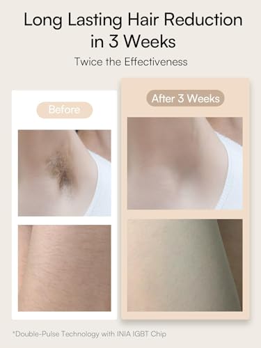 IPL Hair Removal Device with Sapphire Cooling Technology