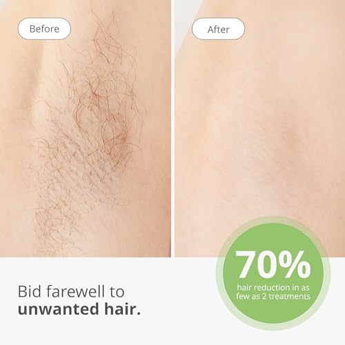 TRIA Cordless Laser Hair Removal Device