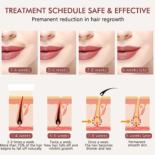 Advanced IPL Hair Removal Device: Effective & Long-Lasting