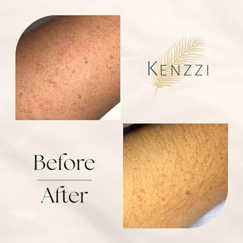 At-Home Kenzzi IPL PRO Hair Removal Device