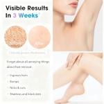 IPL Laser Hair Removal Device, Painless, Corded