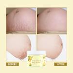 Pregnancy Stretch Mark Cream & Belly Butter 150ml