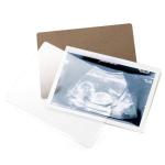 Ultrasound Picture Frame with Countdown for Moms