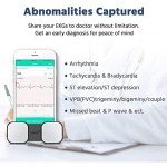 Handheld ECG Monitor for Smartphones - Wireless Tracking