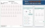 EMAY Standalone Portable ECG Monitor with Screen