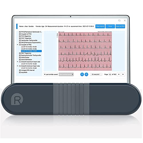 Portable Wellue ECG Monitor for Home Use