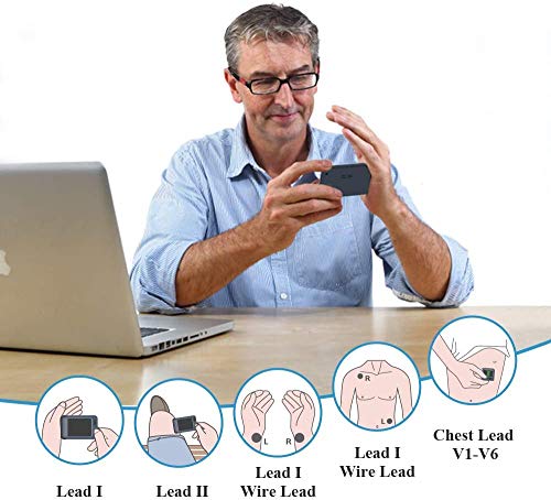 ViATOM Pulsebit-EX ECG Monitor: Portable Heart Health Tracker