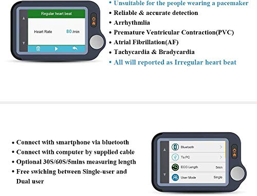 ViATOM Pulsebit-EX ECG Monitor: Portable Heart Health Tracker