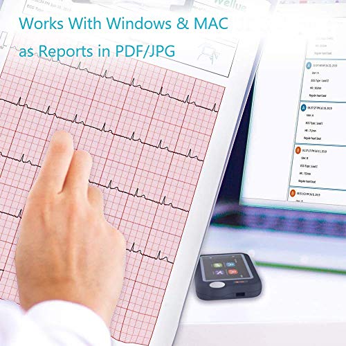 ViATOM Pulsebit-EX ECG Monitor: Portable Heart Health Tracker