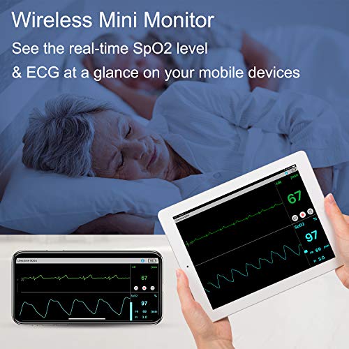 Wireless Checkme Pro: Multi-function Health Monitor