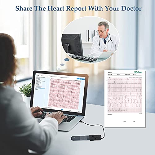 Portable Wellue ECG Monitor for Home Use