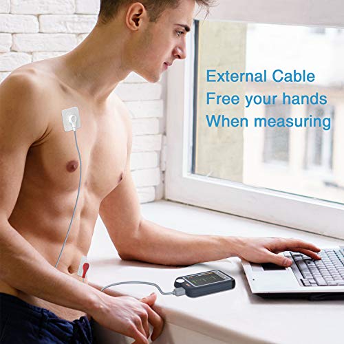 ViATOM Pulsebit-EX ECG Monitor: Portable Heart Health Tracker