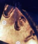 1972 Lincoln Cent DDO FS-101 Gem Quality