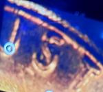 1972 DDO Lincoln Cent - Rare Collectible Coin