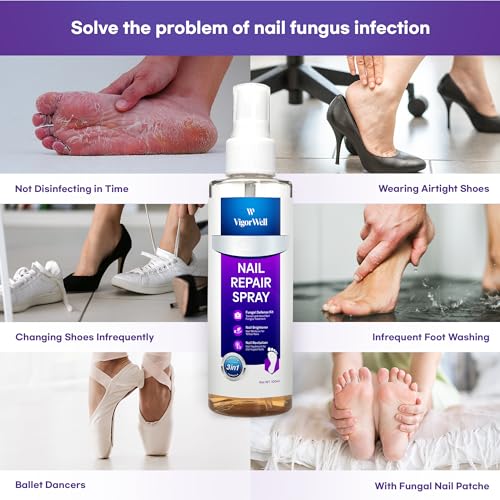 Extra Strength Toenail Fungus Treatment Spray (100 mL)