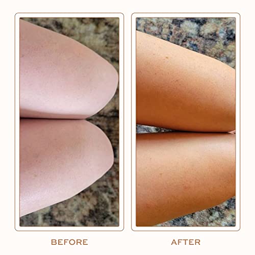 Self Tanner, Sunless Tanner w/Organic and Natural Ingredients, Self Tanning Lotion for Flawless Bronzer Skin, Sunless Tanning Lotion- Self Tan for All Skin Types-Self Tanners Best Sellers, Fake Tan.