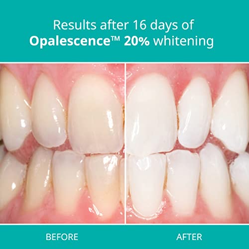 OPALESCENCE 20% PF MINT REFILL KIT Personal Healthcare / Health Care