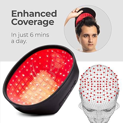 FDA Cleared Capillus ONE Laser Hat for Hair Loss