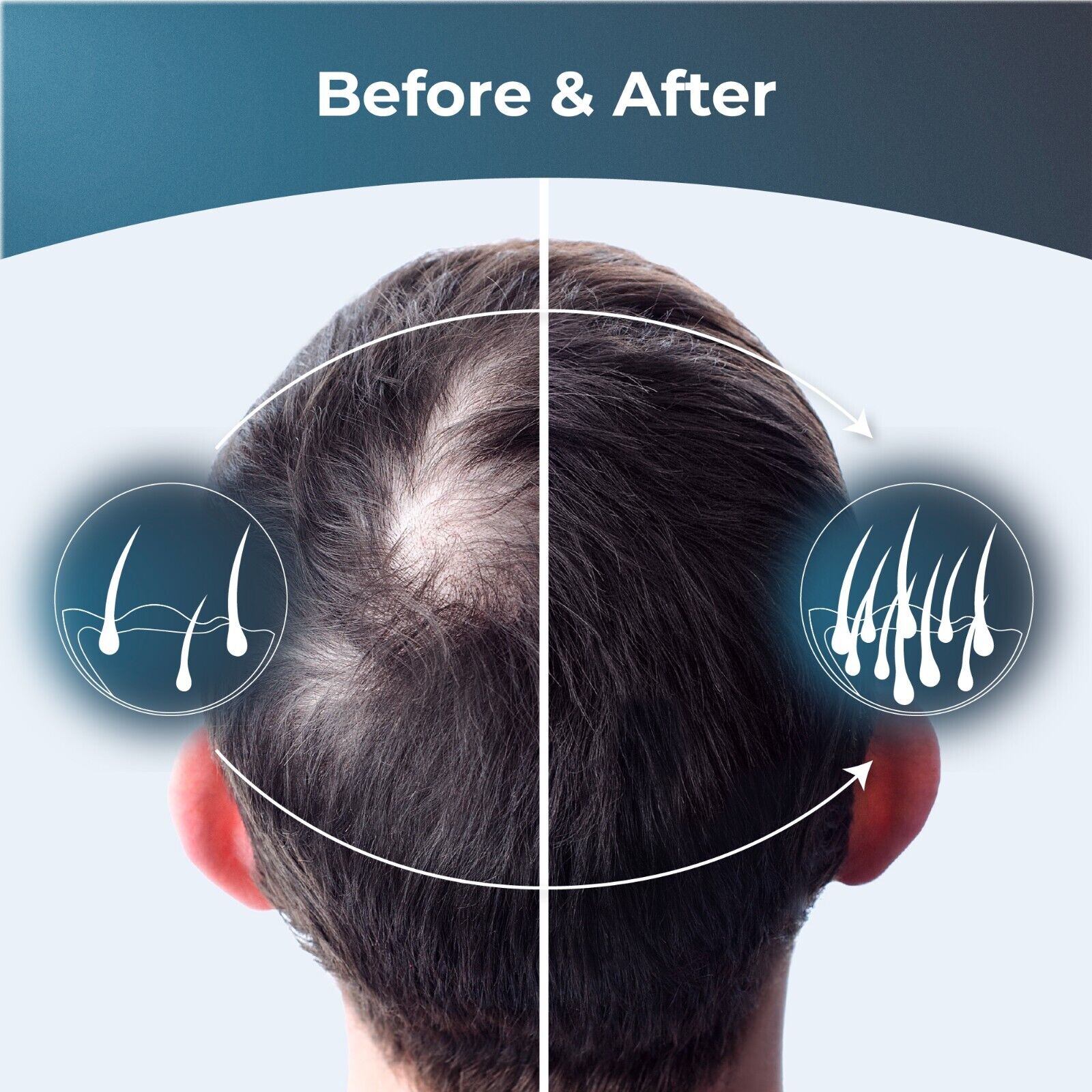 Hair Regrowth Vitamins with Biotin - PureHealth Research