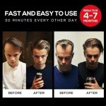 Hair Growth Cap: Laser Therapy for Hair Loss