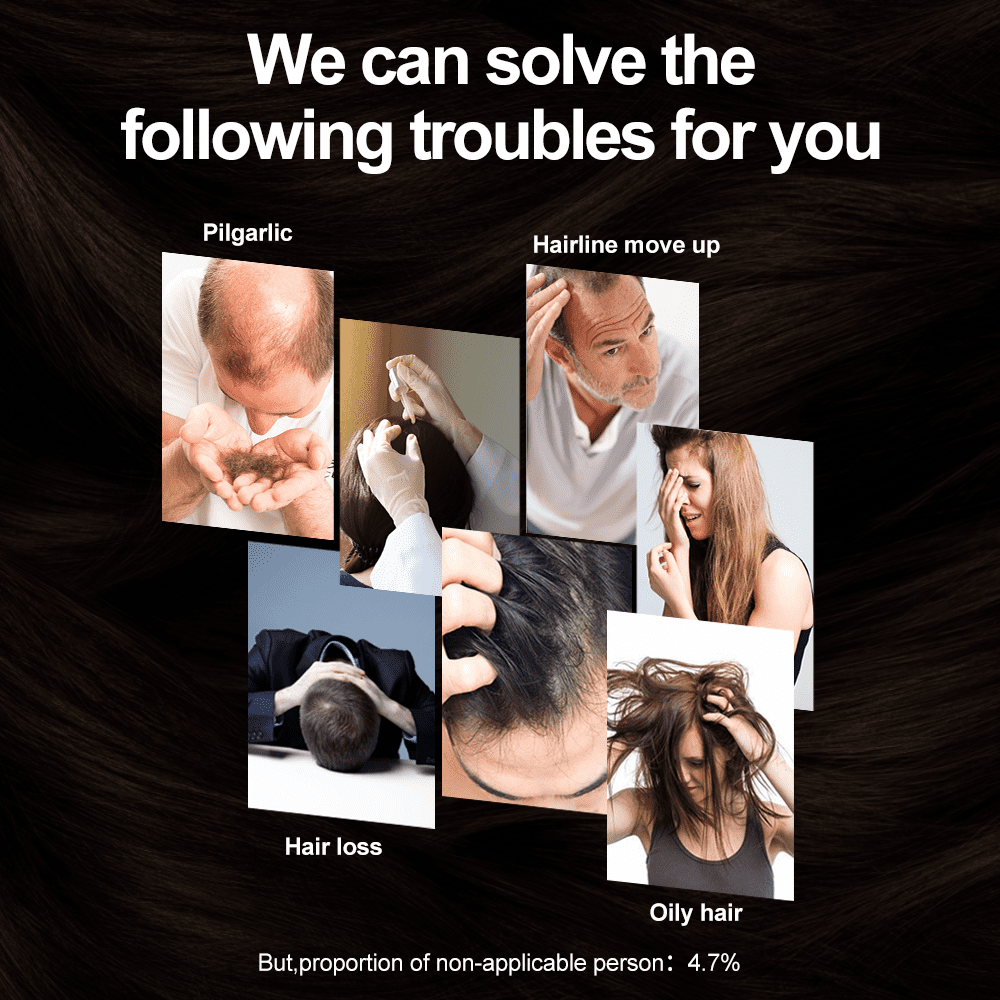 Lescolton Hair Regrowth Laser Helmet - Thinning Hair Solution