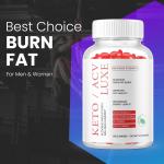 Keto Luxe ACV Gummies - Weight Loss Support