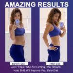 Keto Extreme ACV Gummies - 175,000 MG Apple Cider