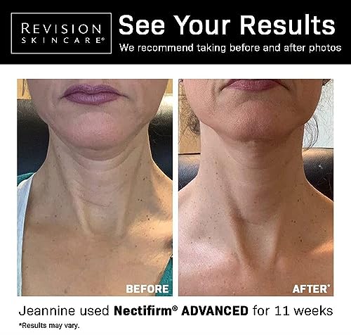 Nectifirm Advanced Neck Firming Cream, Reduce Aging