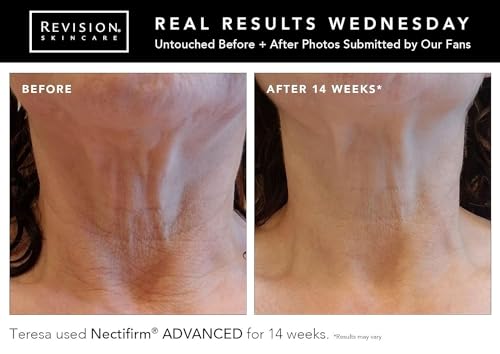 Nectifirm Advanced Neck Firming Cream, Reduce Aging