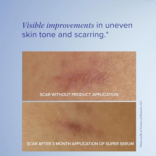 iS CLINICAL Super Serum Advance+ - 0.5 fl oz